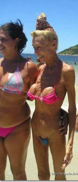 old-lady-with-implants.jpg