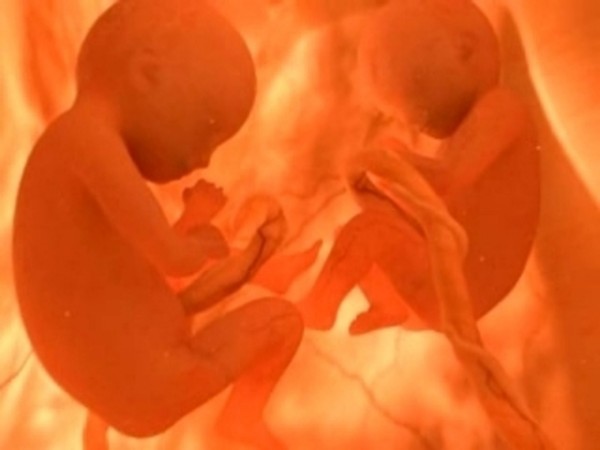 twin baby in womb3.jpg