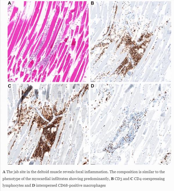 1671265826210824.png image.png