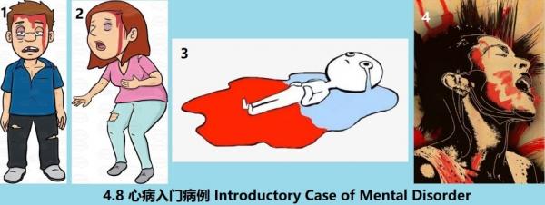 1770916005414191.jpg 4.8 360 心病入門病例 Introductory Case of Mental Disorder.jpg